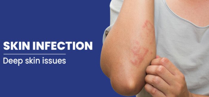 Common skin disorder symptoms: Find out the Symptoms